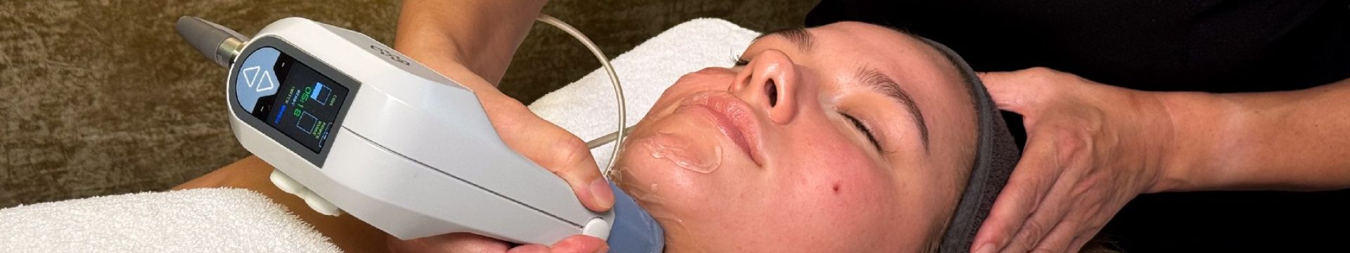 IMG_3095 Radiofrekvence _ Exilis podbradek